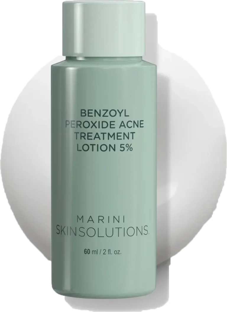Mint green bottle labeled Benzoyl Peroxide Acne Treatment Lotion 5% by Marini SkinSolutions.